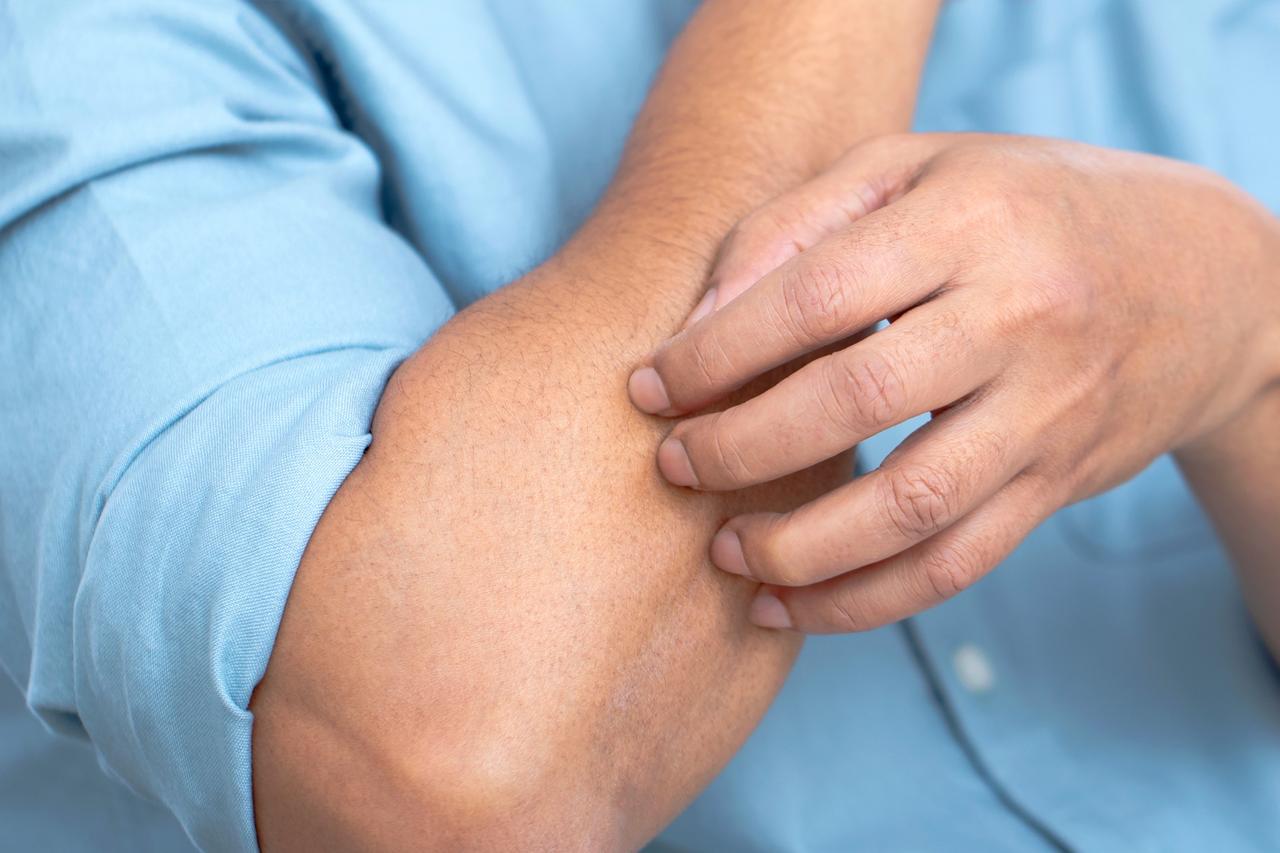 Person scratching irritated elbow while wearing a rolled-up light-blue shirt sleeve.