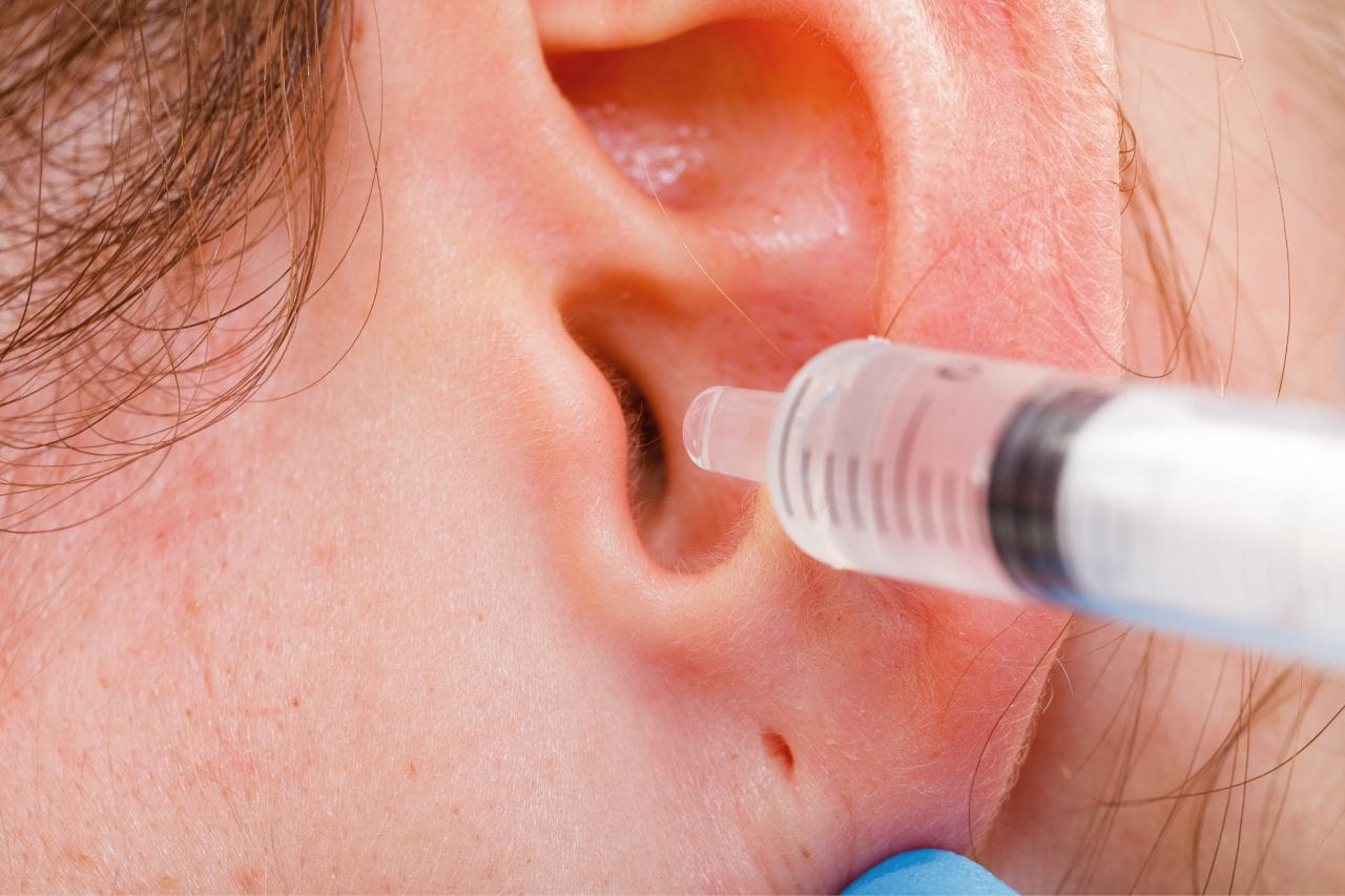 ear wax removal