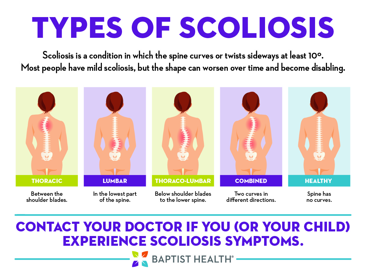 Scoliosis Types Infographic