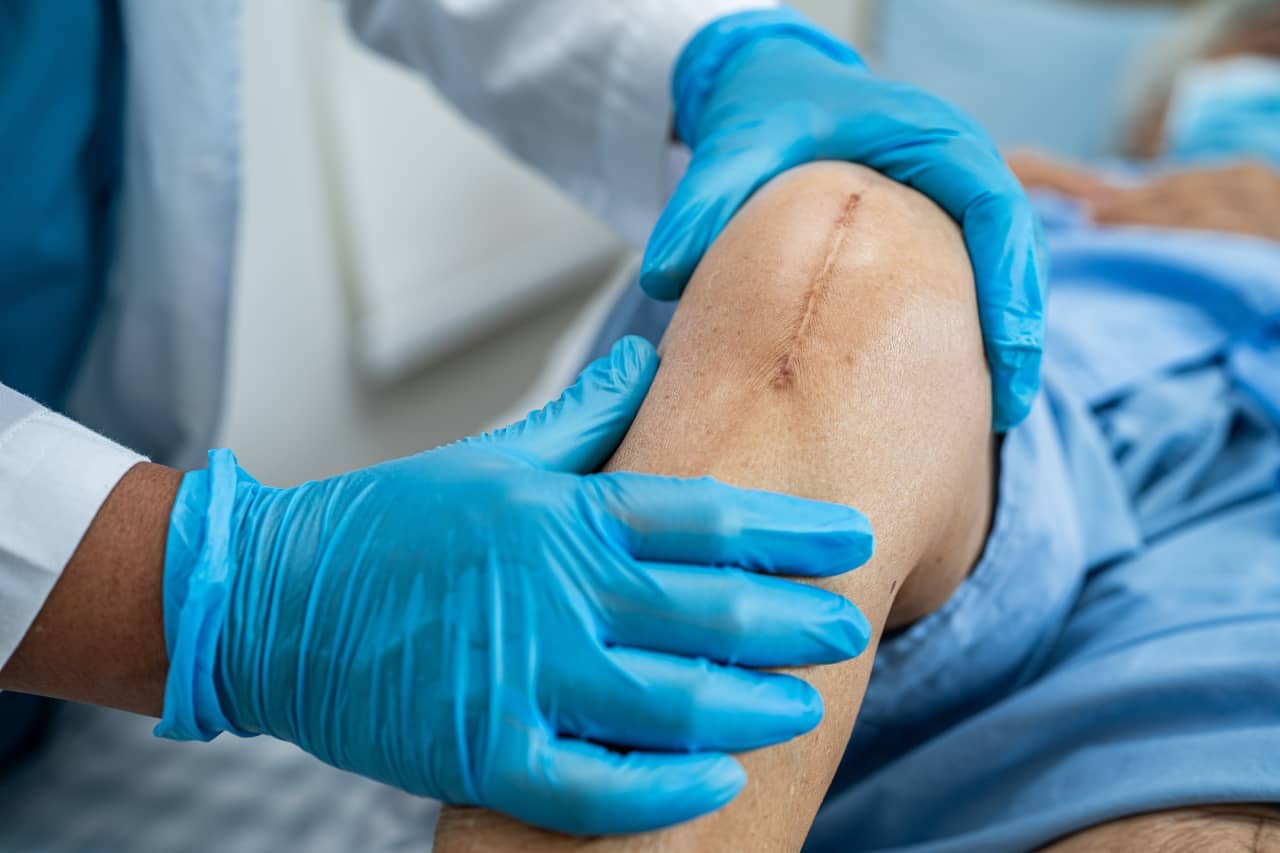 Doctor looking at a stitch on a patients knee