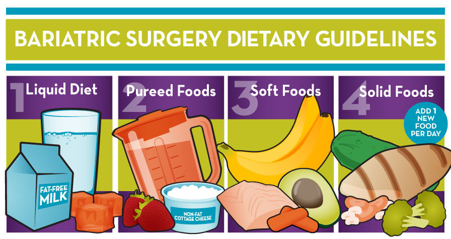 bariatric diet infographic